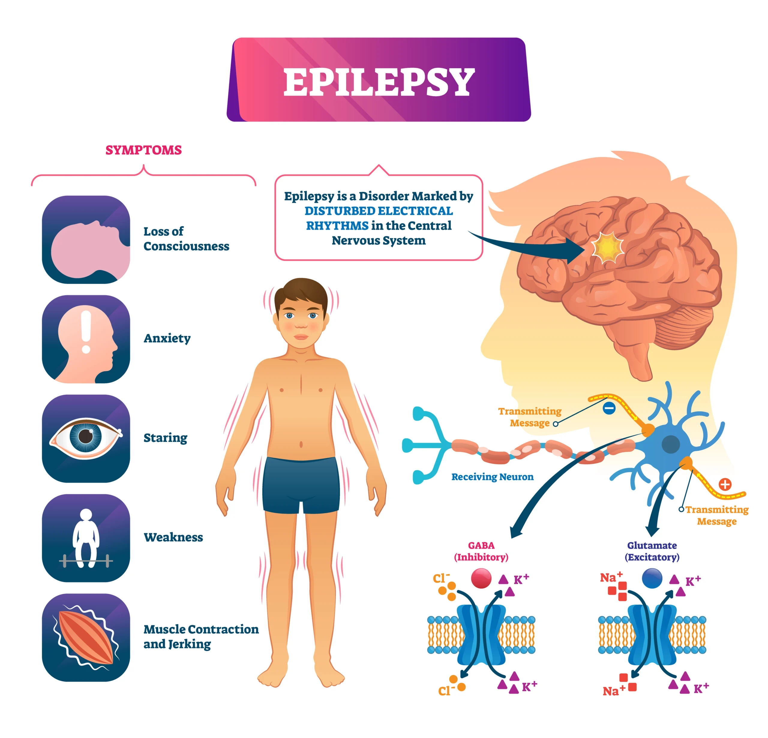 Read more about the article  Epilepsy